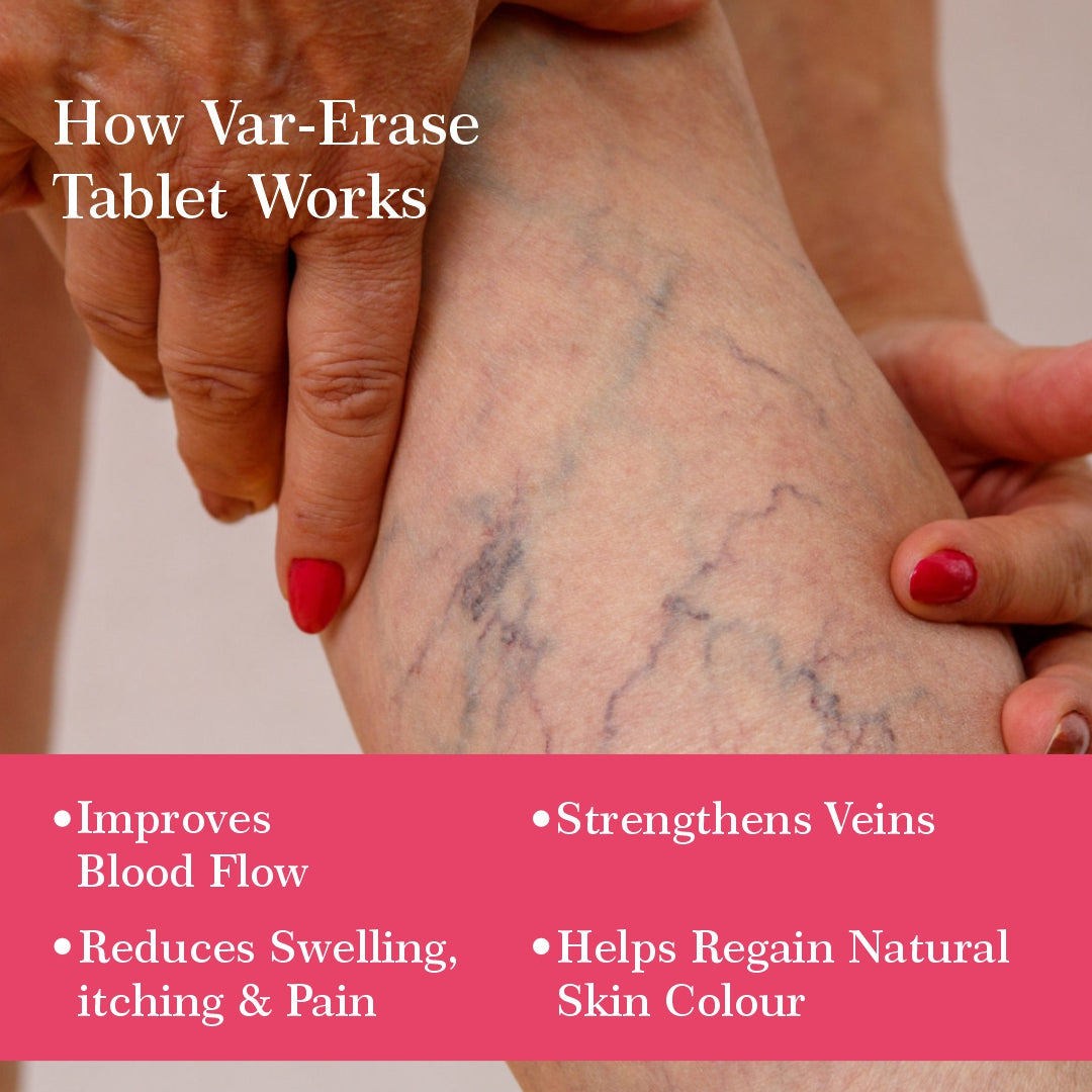 Var-Erase Tablets – Bottle of 60 Tabs