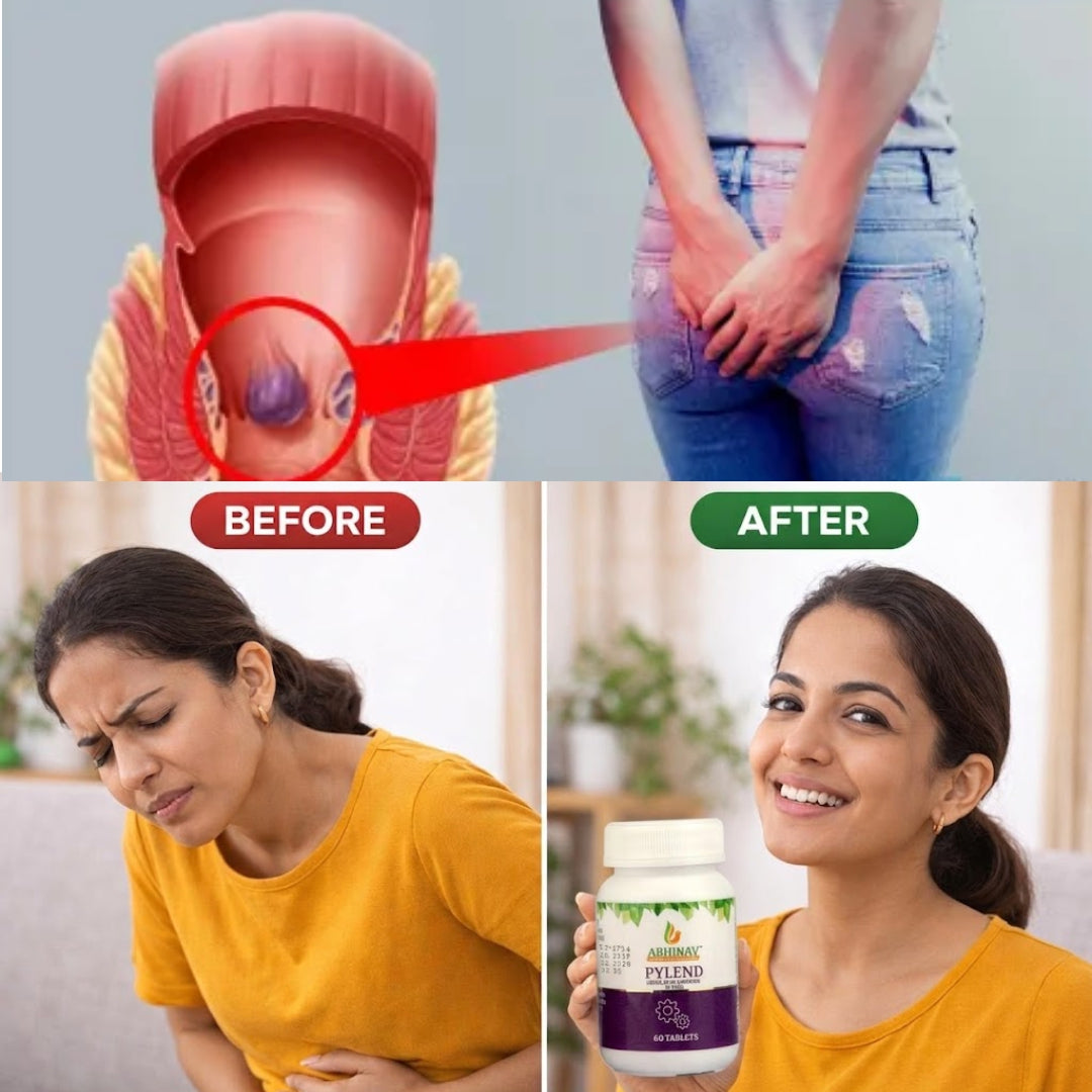 Pylend – Ayurvedic Piles Tablets – 60 Tabs
