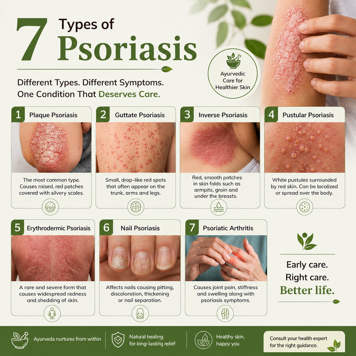 D-Scale | Psoriasis Care Kit