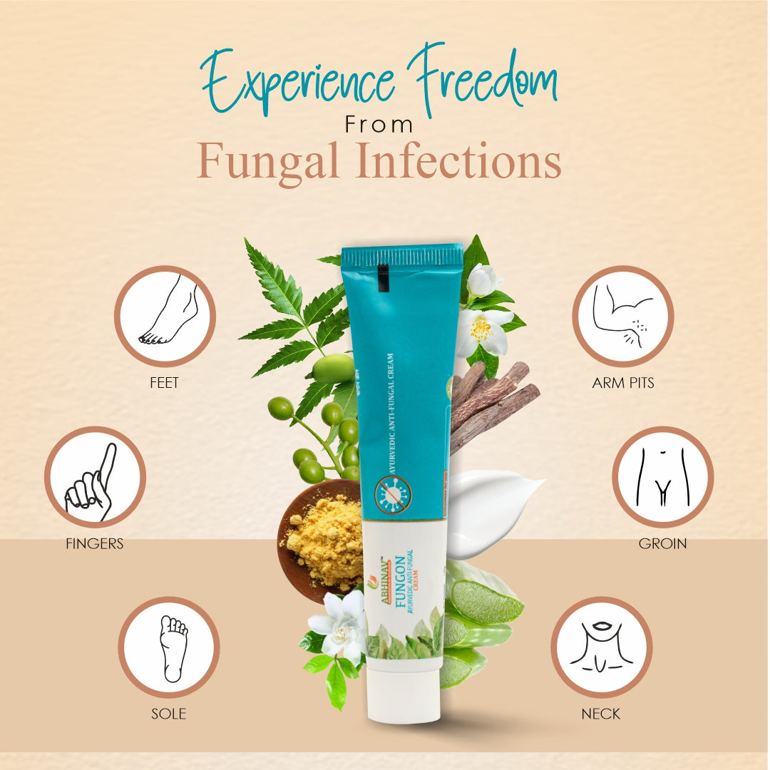 Fungon – Antifungal Cream -Tube Of 25 Gm