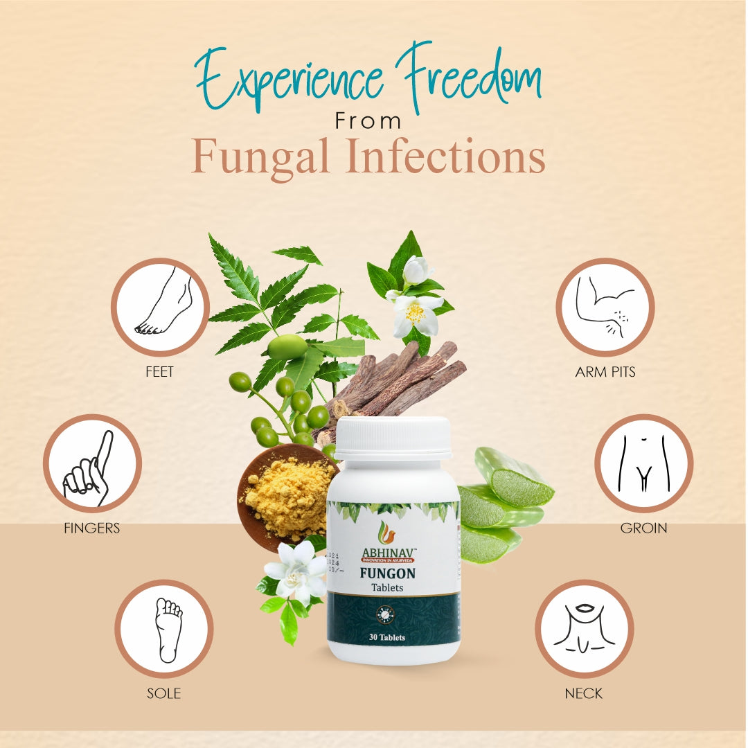 Fungon – Antifungal Tablets for Skin – Bottle of 30 Tabs