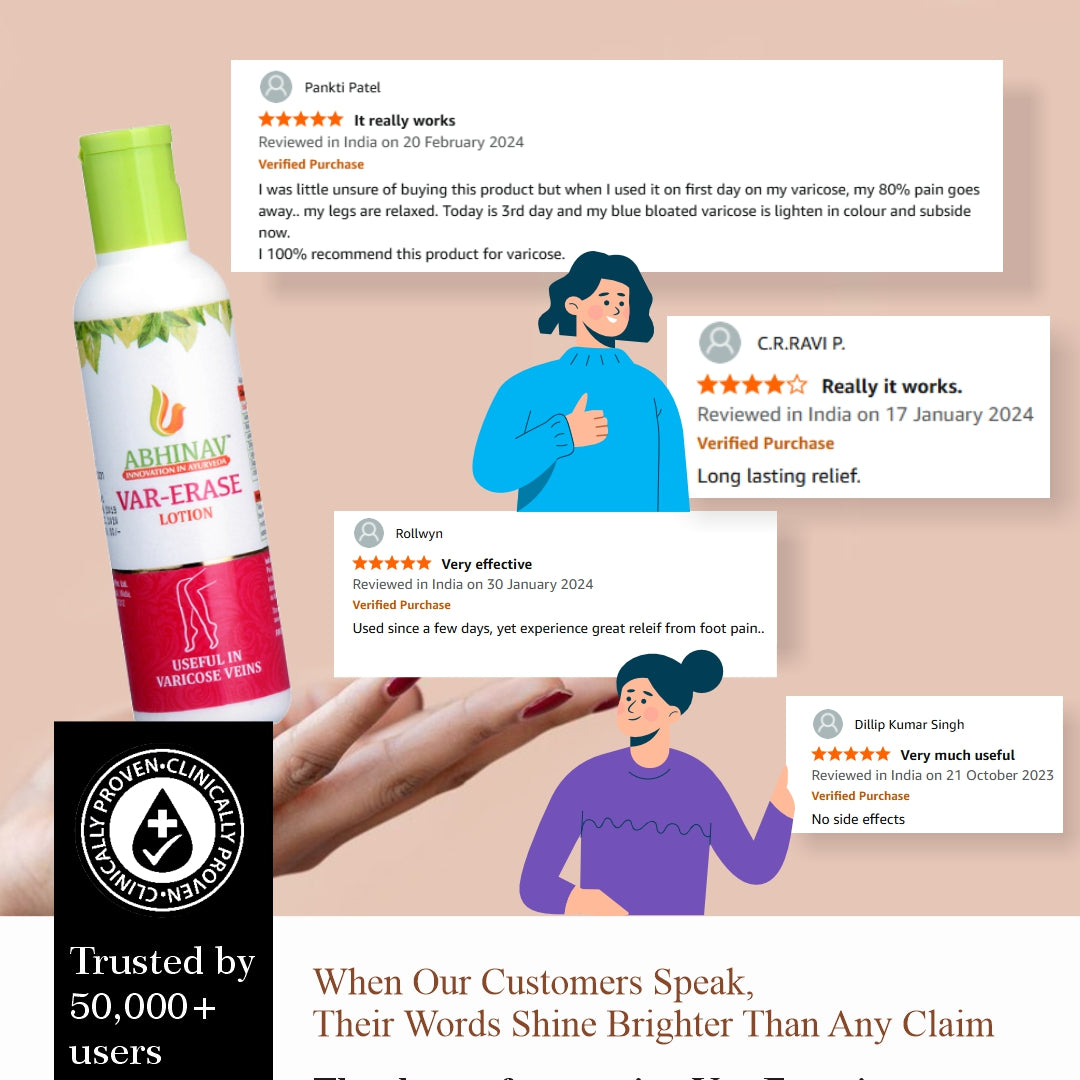 Var-Erase | Ayurvedic Varicose Veins Lotion – 100 gm