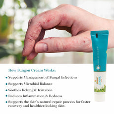 Fungon – Antifungal Cream -Tube Of 25 Gm
