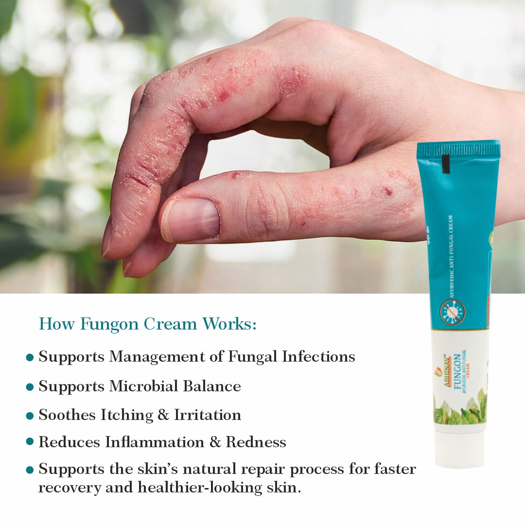 Fungon – Antifungal Cream -Tube Of 25 Gm