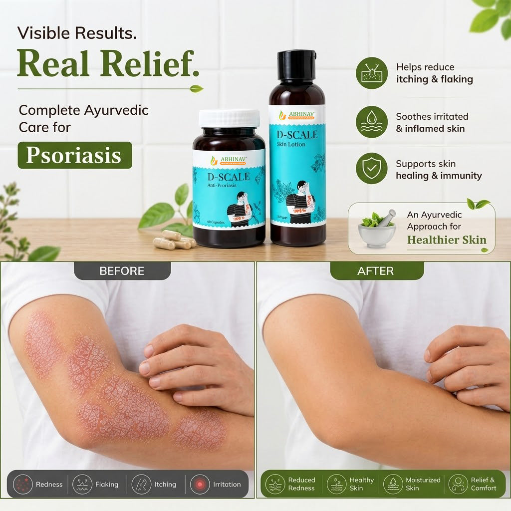 D-Scale | Psoriasis Combo Kit – Capsules + Lotion