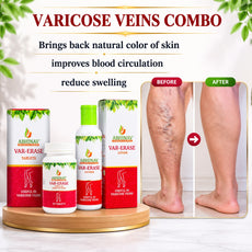 Varicose Veins Treatment Combo