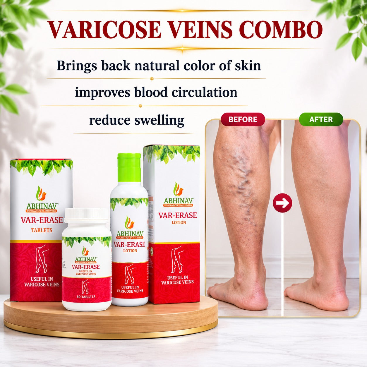 Varicose Veins Treatment Combo