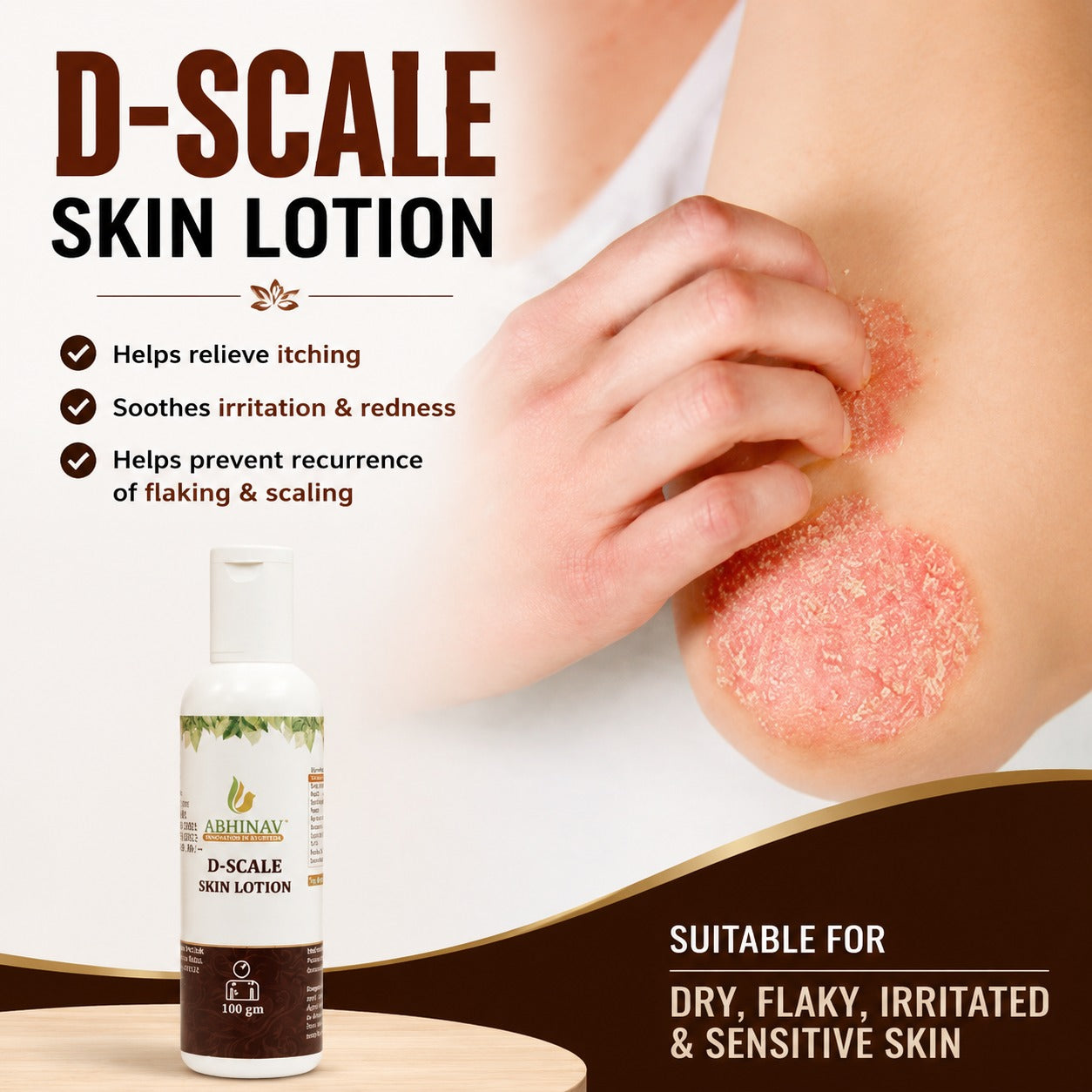 D-Scale | Psoriasis Lotion – Bottle of 100gm