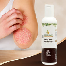 D-Scale | Psoriasis Lotion – Bottle of 100gm