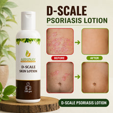 D-Scale | Psoriasis Lotion – Bottle of 100gm