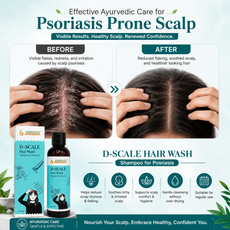 D-Scale | Psoriasis Hair Wash – Bottle of 100gm