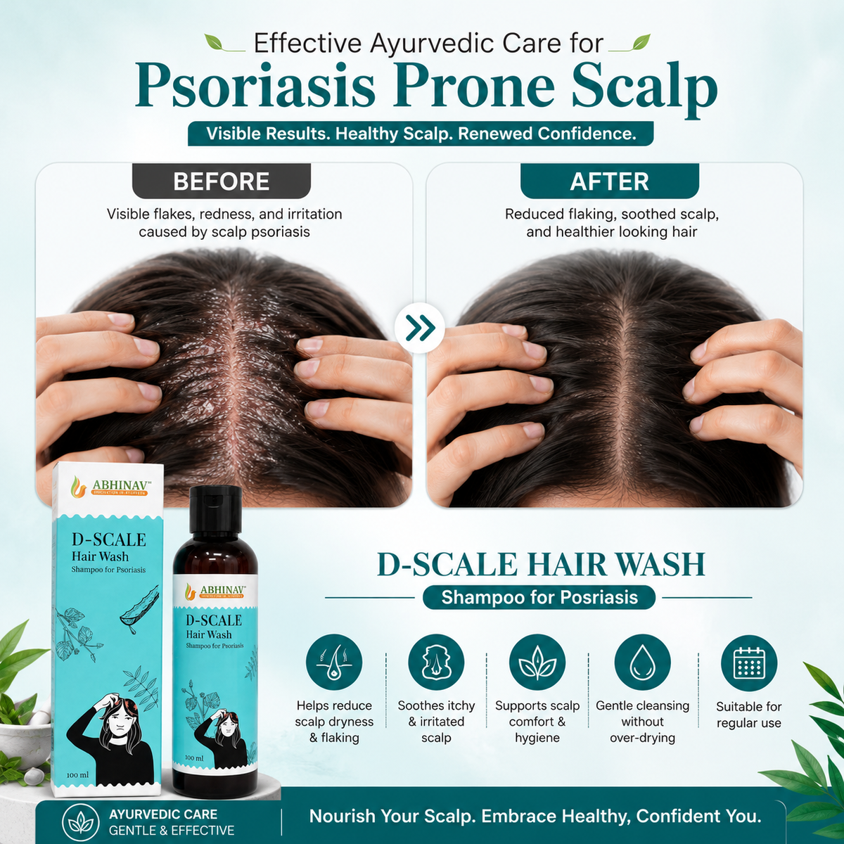 D-Scale | Psoriasis Hair Wash – Bottle of 100gm