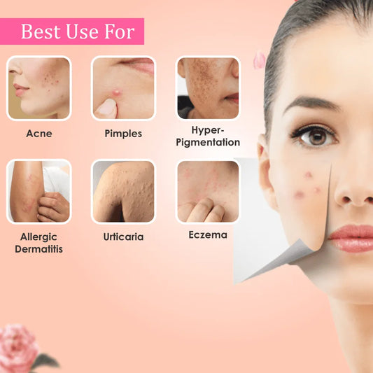 Gloderm – Ayurvedic Face Whitening Cream