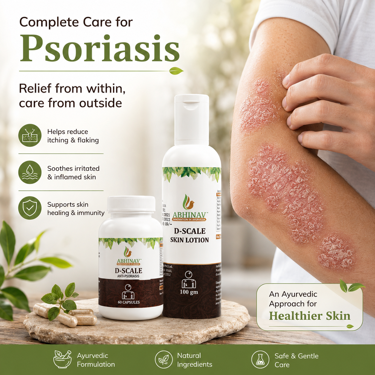 D-Scale | Psoriasis Combo Kit – Capsules + Lotion