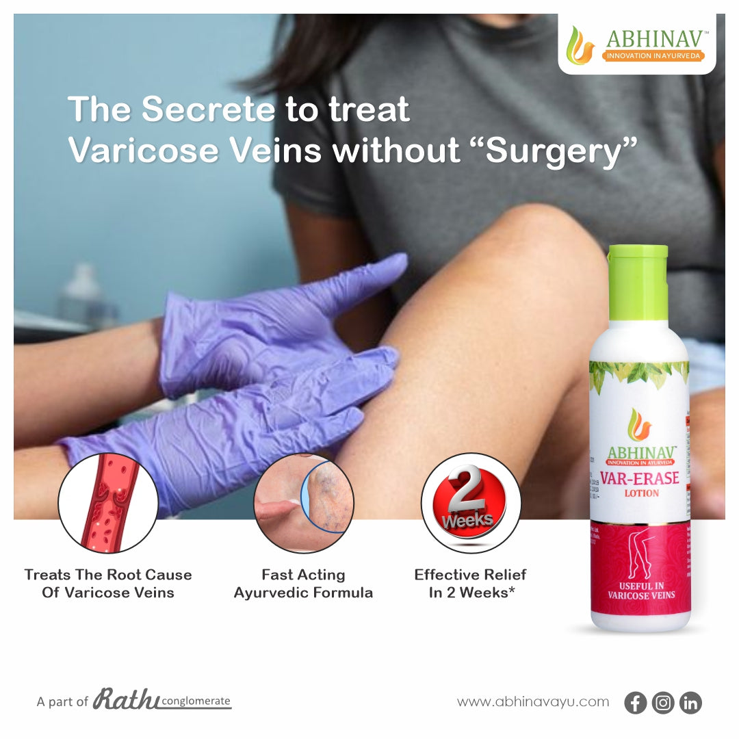 Var-Erase | Ayurvedic Varicose Veins Lotion – 100 gm