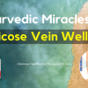 Ayurvedic-Miracles-for-Varicose-Vein-Wellness