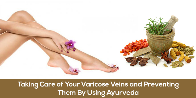 Taking-Care-of-Your-Varicose-Veins-and-Preventing-Them-By-Using-Ayurveda