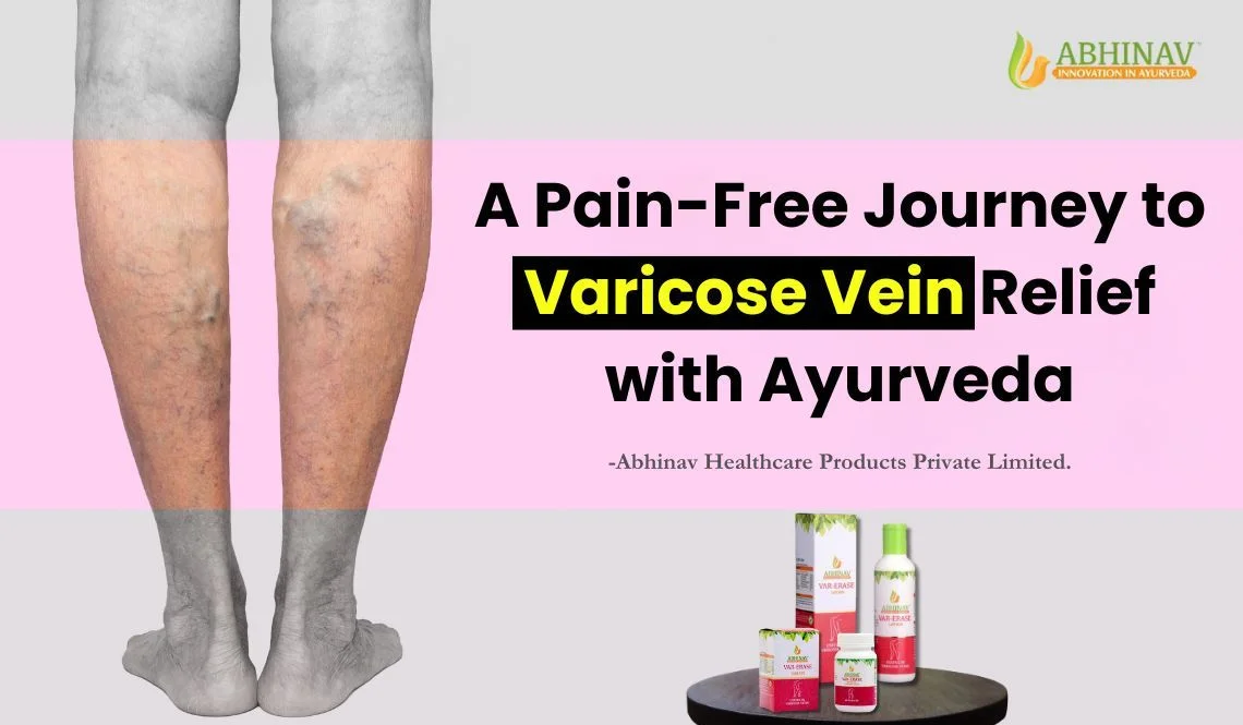 Ayurvedic Medicine for Varicose Veins