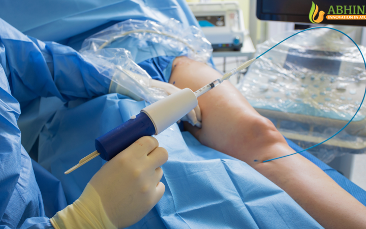 Best Ayurvedic Medicine for Varicose Veins in India (2026 Guide)