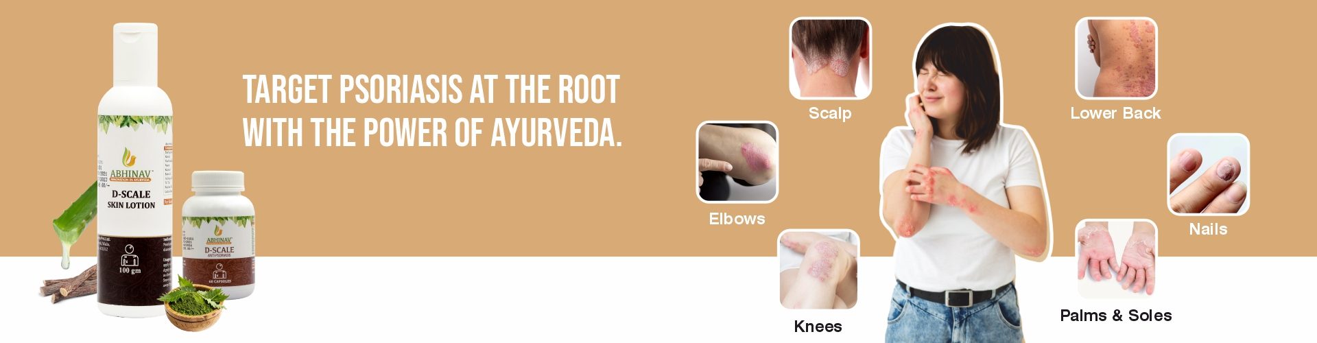 Ayurvedic Treatment for Varicose Veins and Vaginal Dryness - Var-Erase & Vimosa